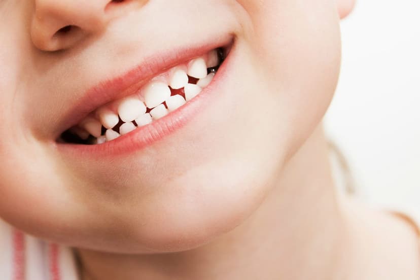 El espacio entre dientes temporarios "de leche" nos dice mucho