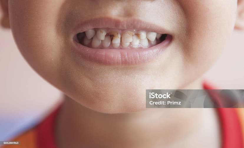 Caries en bebés y niños